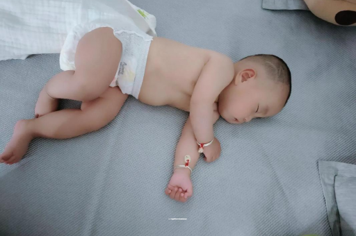 安顺宝宝褶皱处擦粉还是油